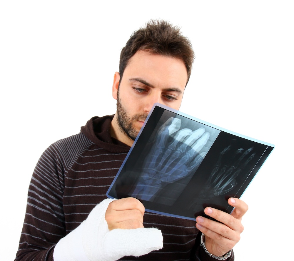 a man looking at his own x-ray